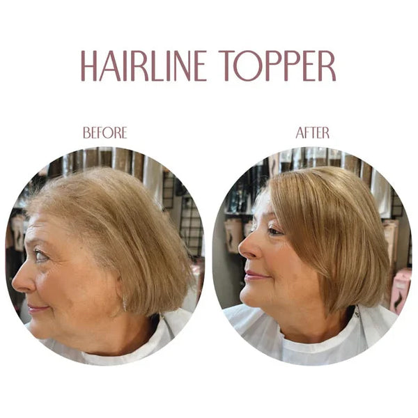 💯Hairline Band – Limited Stock, Upgrade Your Look Today! 🔥