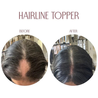 💯Hairline Band – Limited Stock, Upgrade Your Look Today! 🔥